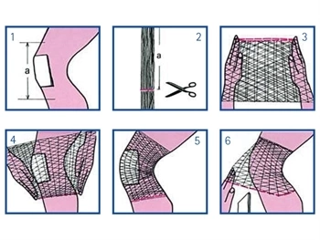 SURGIFIX - Rete tubolare elastica calibro 5 per ginocchio e gamba - immagine 2
